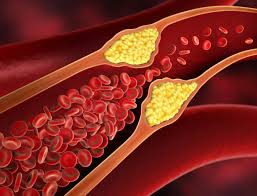 Healthy meal for cholesterol management